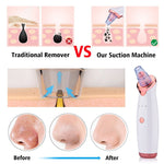 Blackhead Instrument Electric Suction Facial Washing Instrument Beauty Acne Cleaning Blackhead Suction Instrument